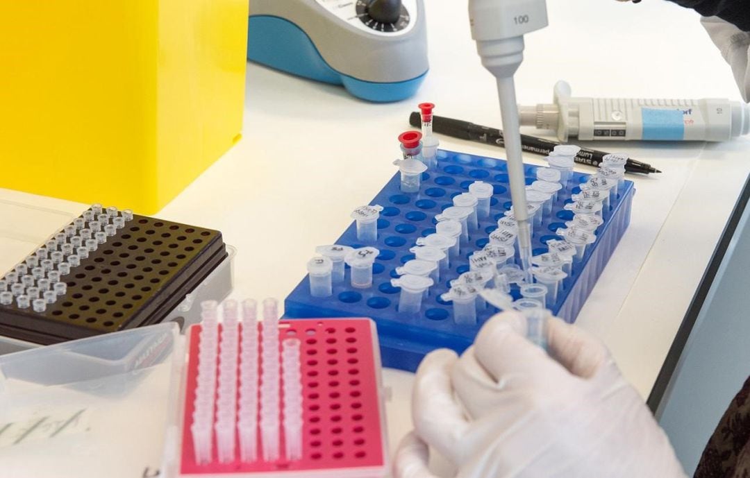 Los investigadores estudian tratamientos frente al COVID-19.