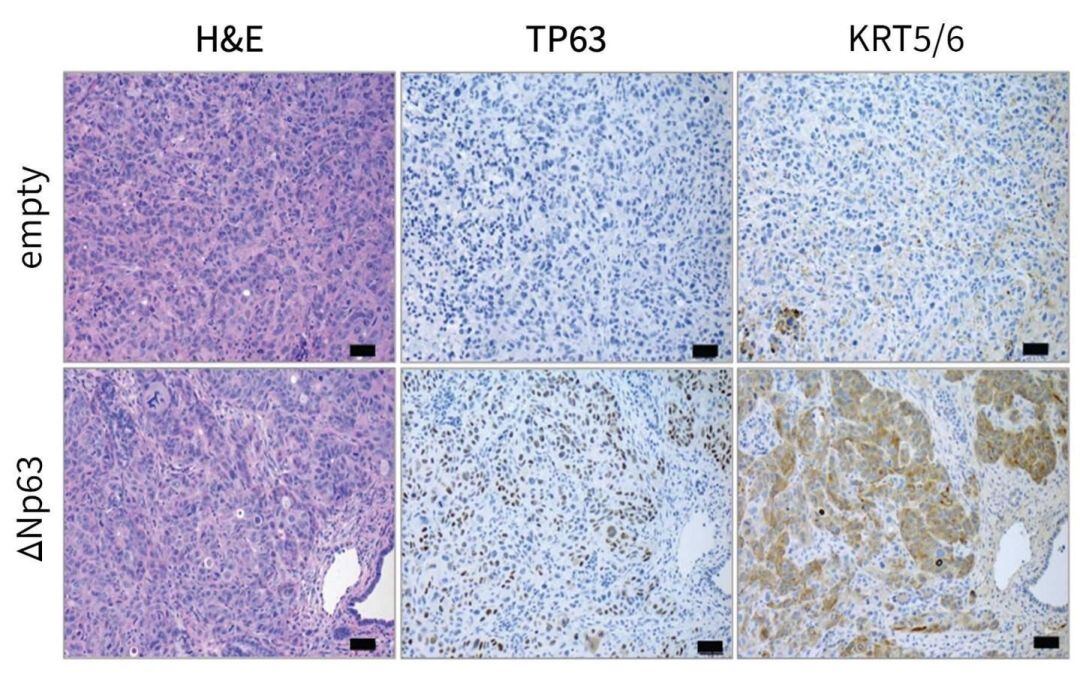 La sintomatología del cáncer de páncreas es muy silenciosa y a menudo los síntomas aparecen ya en las últimas fases de la enfermedad,