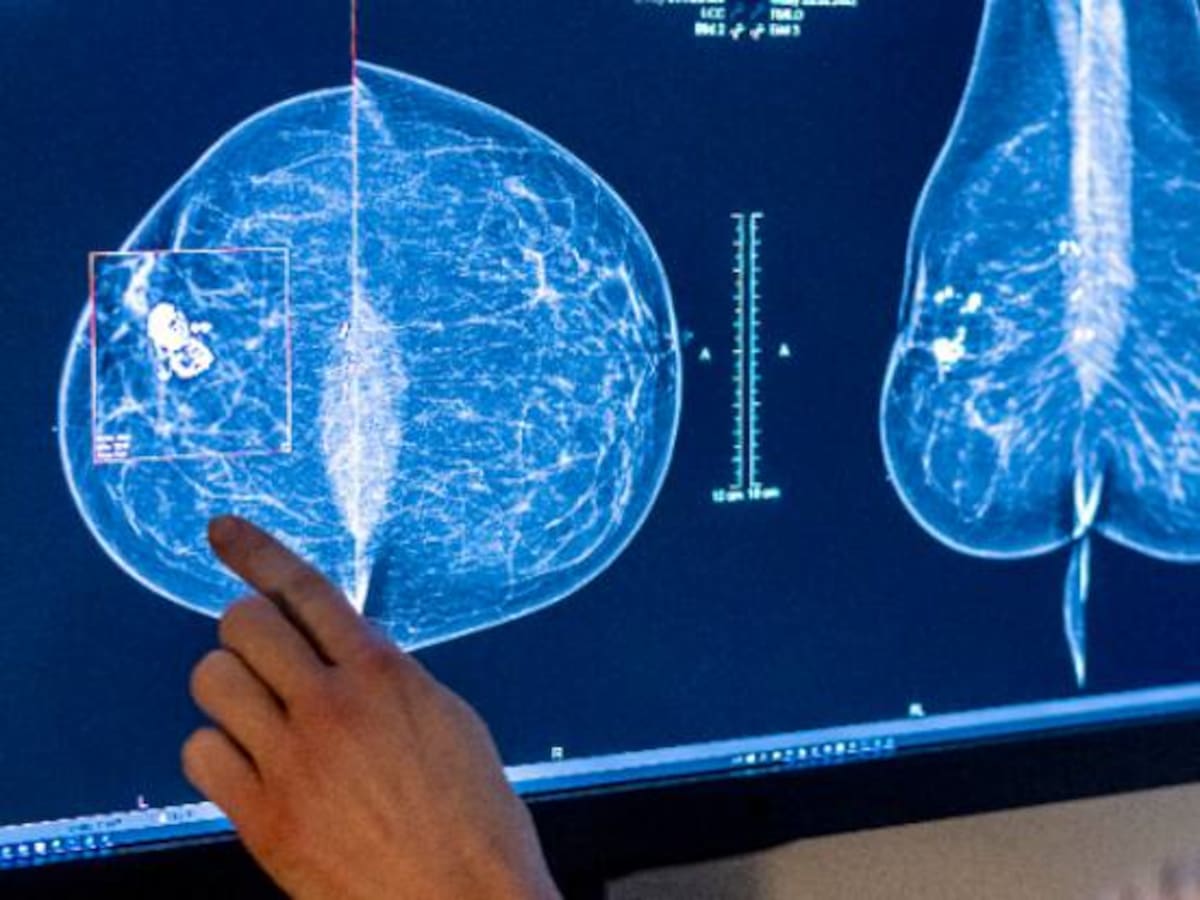 Xàtiva se incorpora a la red de atención integral a pacientes con cáncer