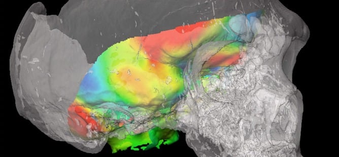 Imagen de la base interior del cráneo de un Homo Sapiens