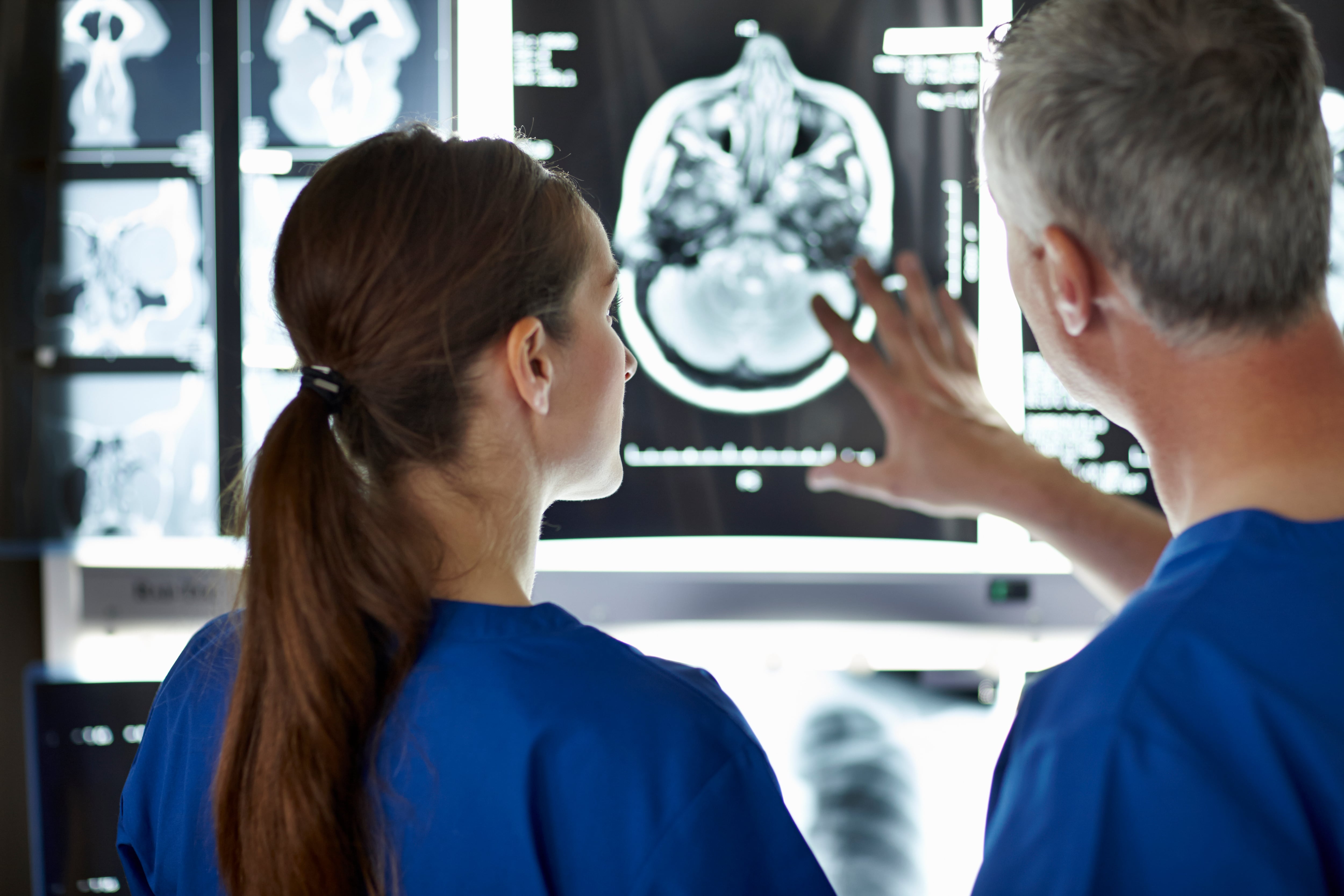 Profesionales sanitarios revisan una radiografía cerebral, en una imagen de archivo