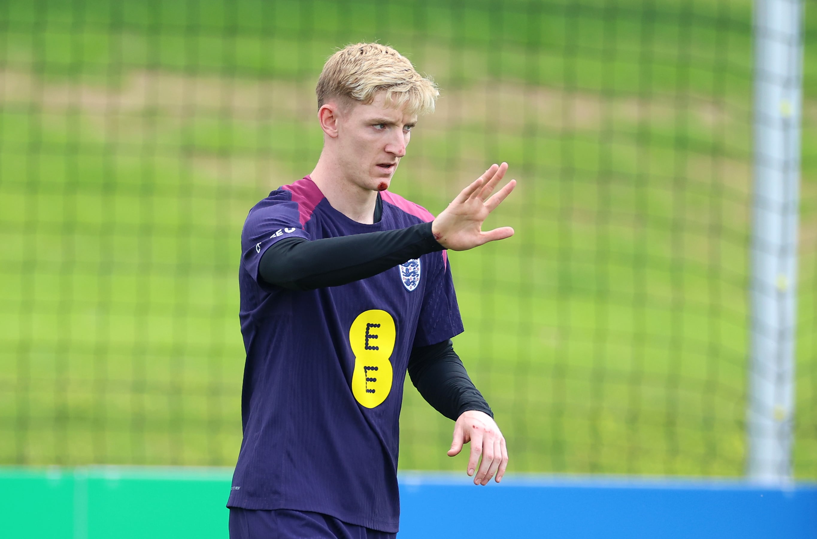 Anthony Gordon reaparece con diferentes magulladuras en el entrenamiento de Inglaterra