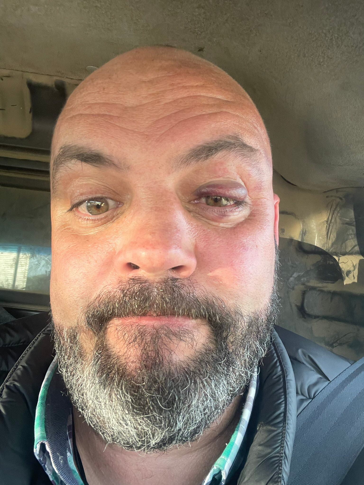 Txema Ortega ensenyant com li va quedar l&#039;ull.