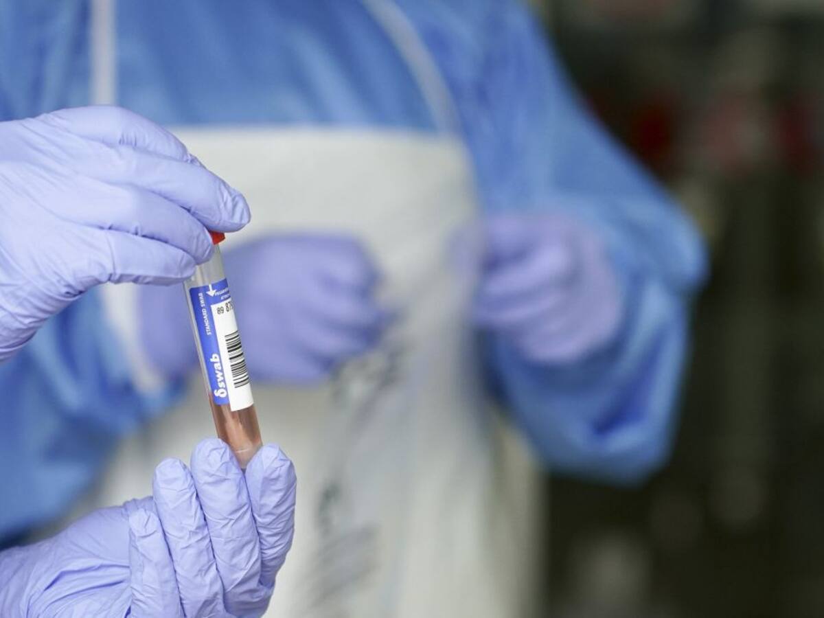 Castilla y León registra 775 positivos, otros 16 fallecidos más y 73 nuevas altas