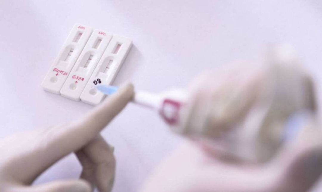 Test rápidos para detectar el coronavirus  
 