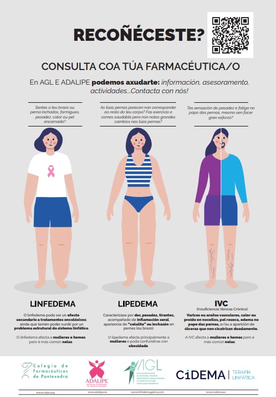 Linfedema, Lipedema e Insuficiencia Venosa Crónica