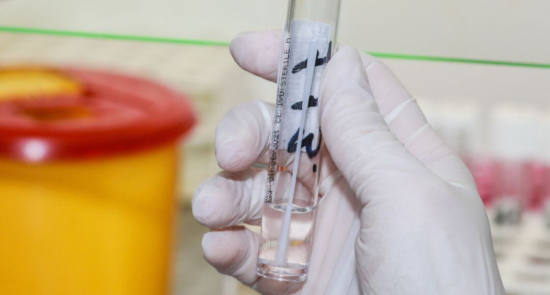 Prueba PCR de coronavirus.