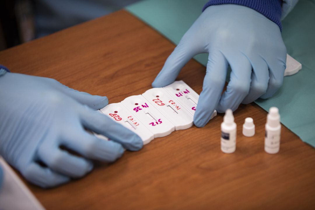 Pruebas detección Covid19.