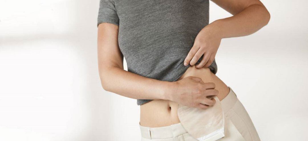 Exposición sobre ostomía en Palencia