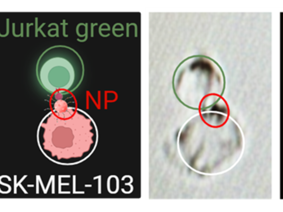 Desarrollan una nanopartícula que abre una nueva vía en la lucha contra el cáncer