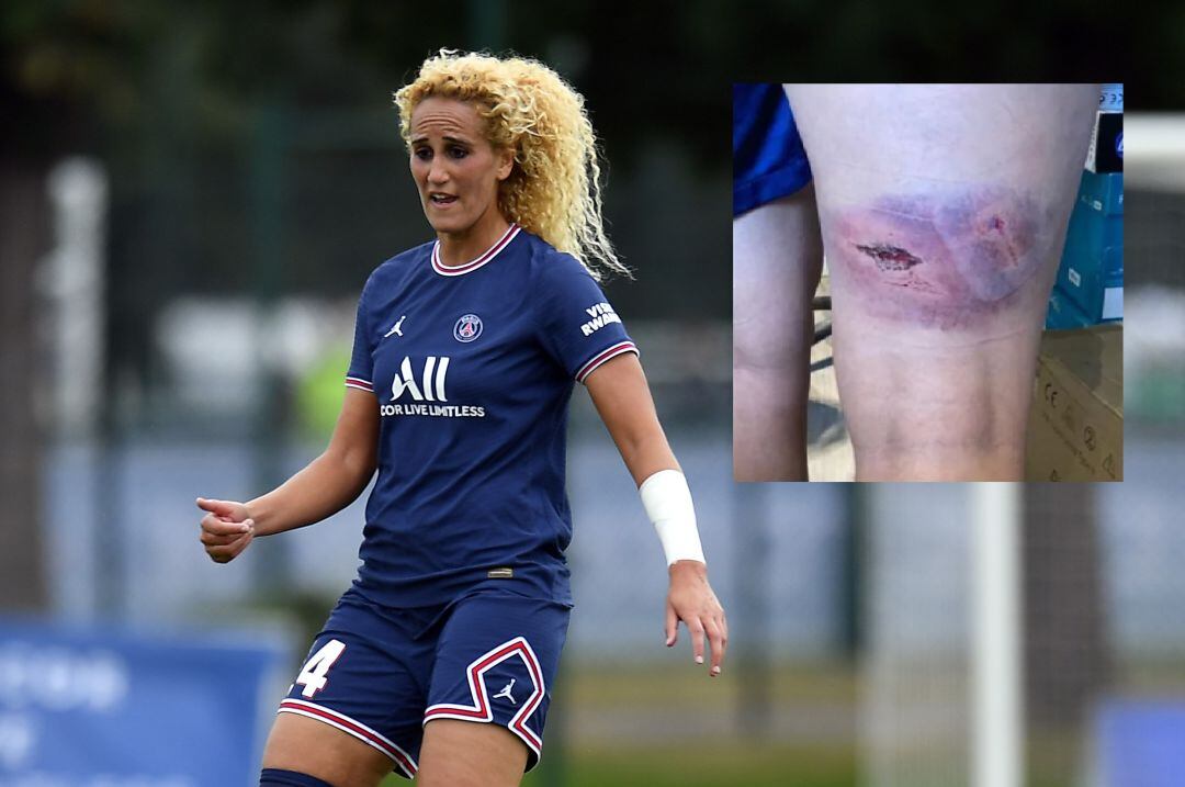 Hamraoui, junto a la imagen de su pierna a la que ha accedió L'Equipe