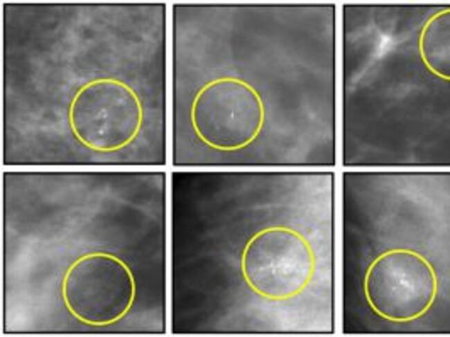 Anomalías que consiguieron detectar las palomas.
