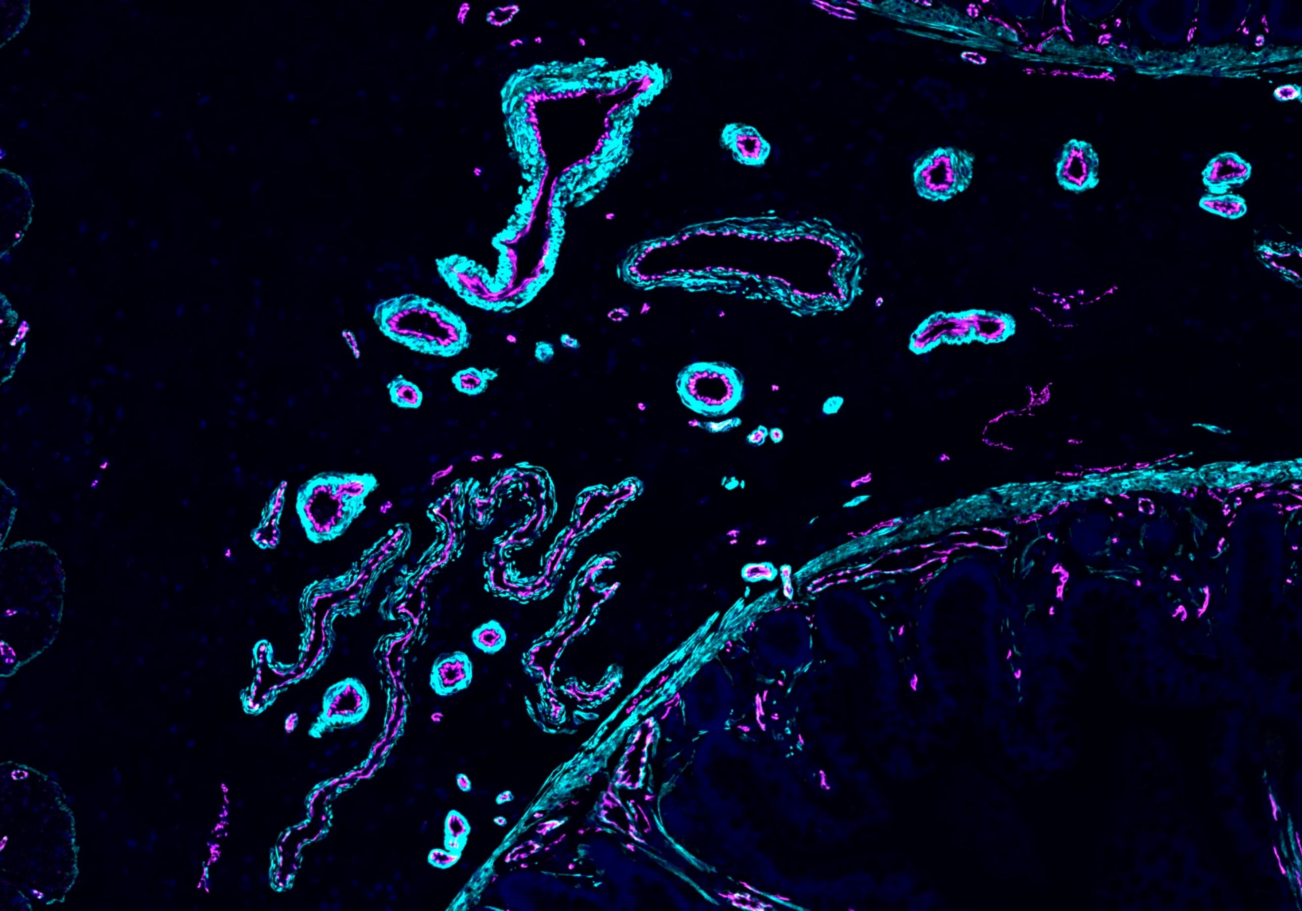 Vasos sanguíneos en una muestra de íleon humano. La tinción con inmunofluorescencia destaca las células endoteliales en magenta, marcadas por CDH5, y las células de músculo liso en cian, marcadas con ACTA2.1. Crédito de la imagen: Ana-Maria Cujba
