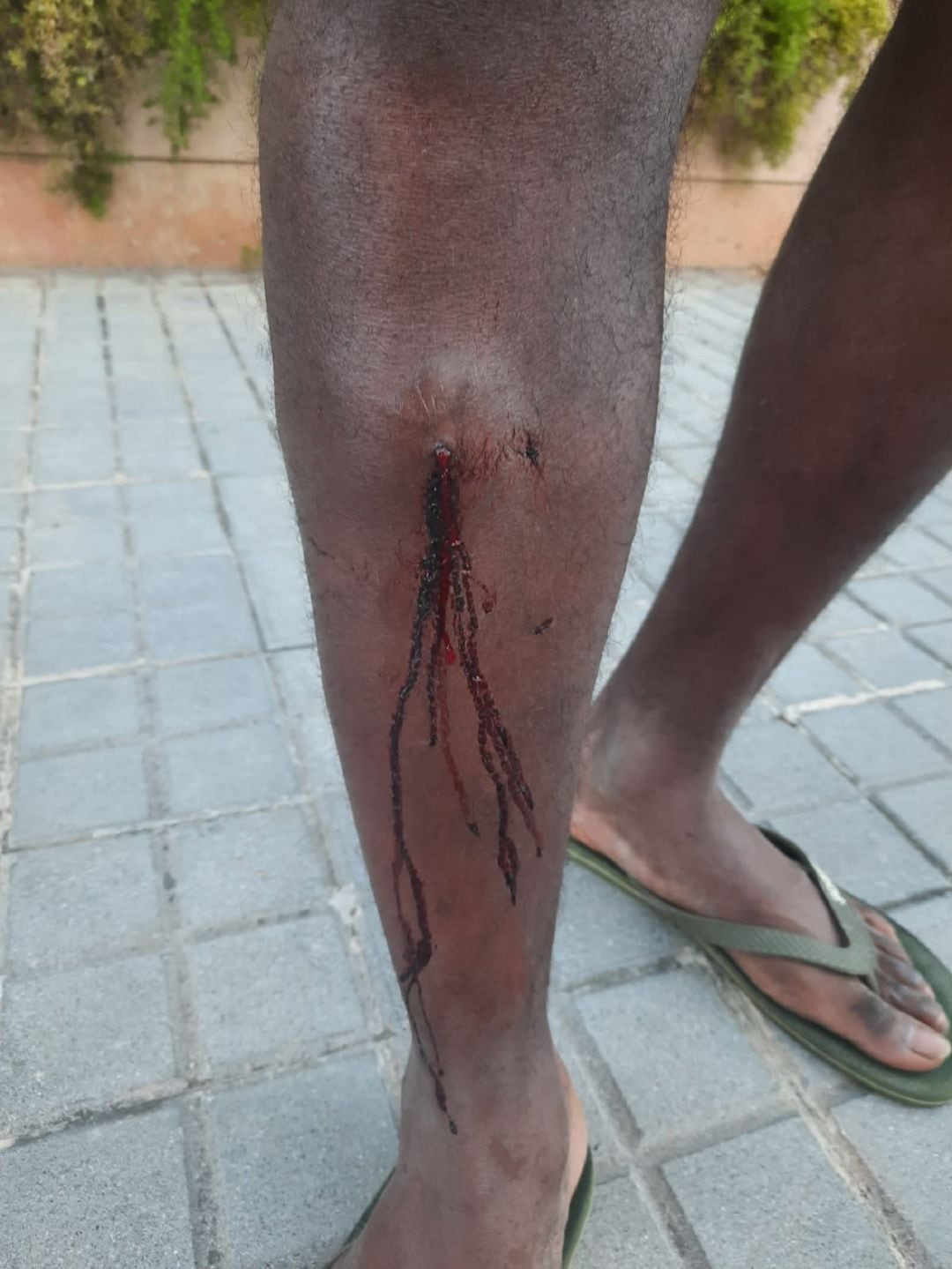 Les ferides que denúncia el jove