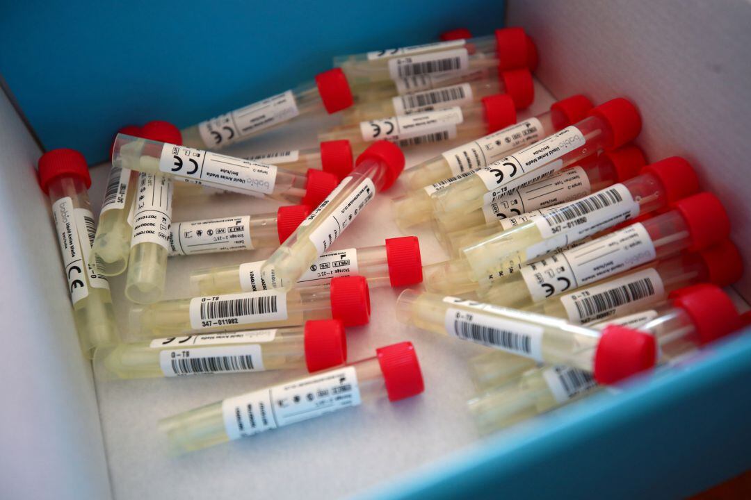 Muestras de tests de coronavirus, en una imagen de archivo