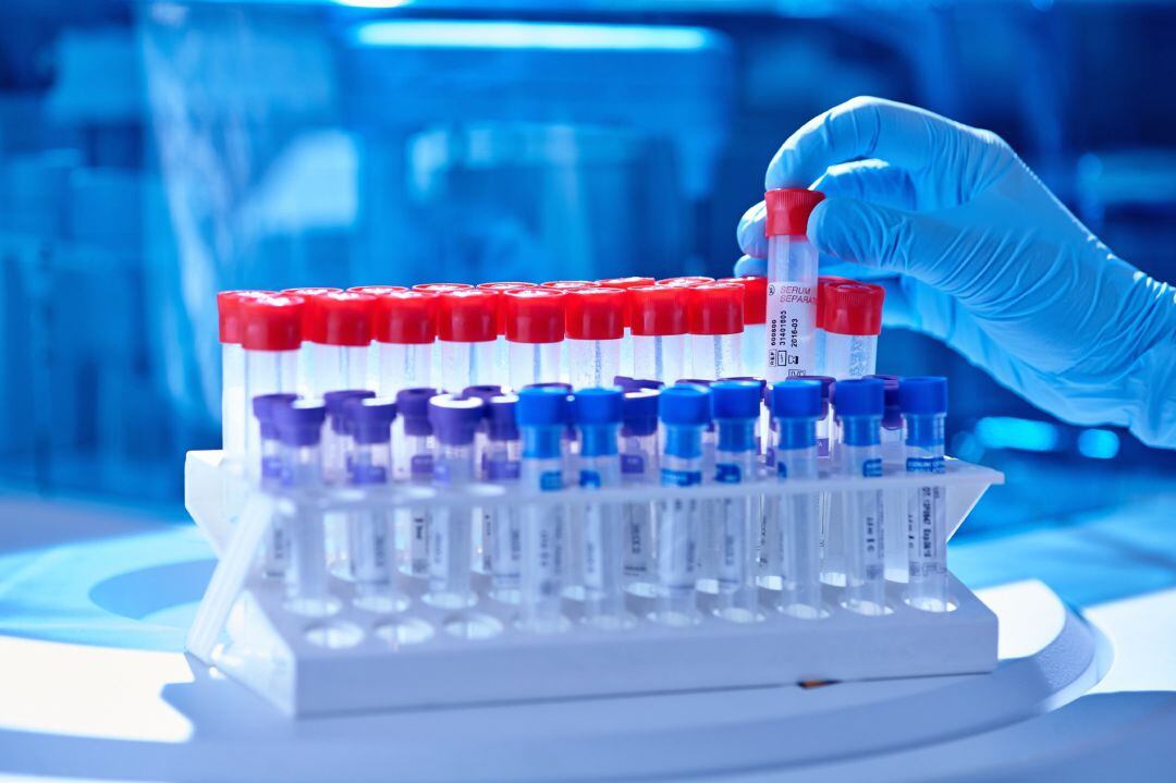 Pruebas PCR en un laboratorio.