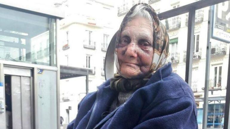 Una mujer de 84 años recibe una paliza en Madrid