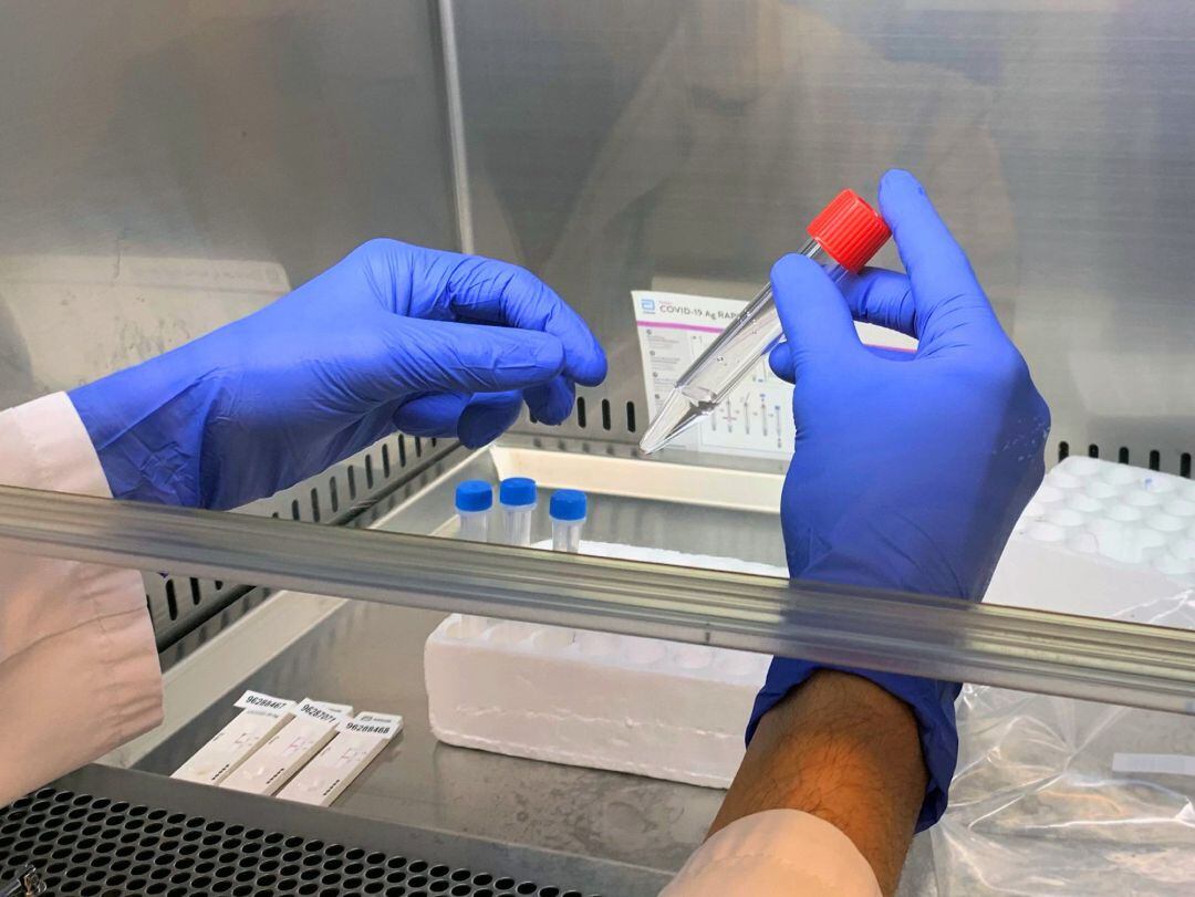 Probetas para la realización de pruebas PCR con muestra en saliva.