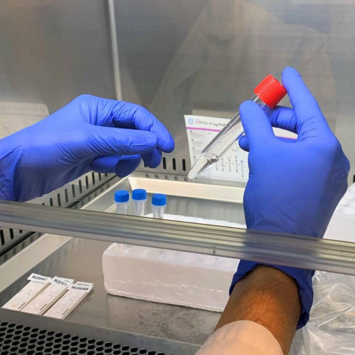 Asturias confirma 73 nuevos casos de COVID-19 y la tasa de positividad cae al 2,8%