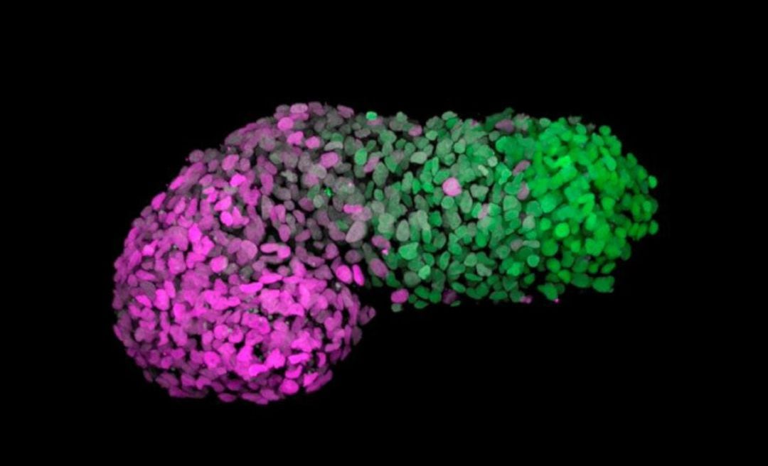 Un gastruloide humano desde un patrón &#039;anteroposterior&#039;. El verde marca la parte posterior que es similar al extremo de la cola de un embrión y el magenta marca la parte anterior que es similar a las células del corazón en desarrollo. Un equipo internacional de científicos ha generado, a partir de células madre humanas, un modelo similar al de un embrión humano que recrea las primeras etapas del desarrollo embrionario y que, por tanto, será de gran ayuda para investigar el origen de algunas malformaciones y observar el desarrollo de muchas enfermedades.