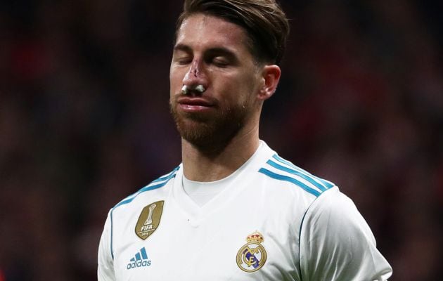 Sergio Ramos, después del golpe que recibió de Lucas Hernández.