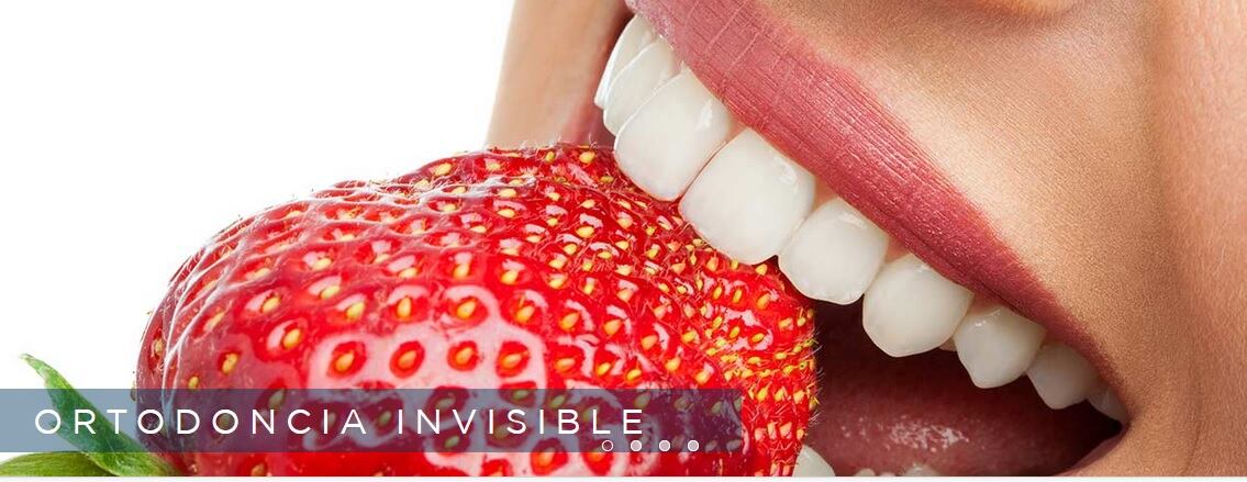 Ortodoncia invisible