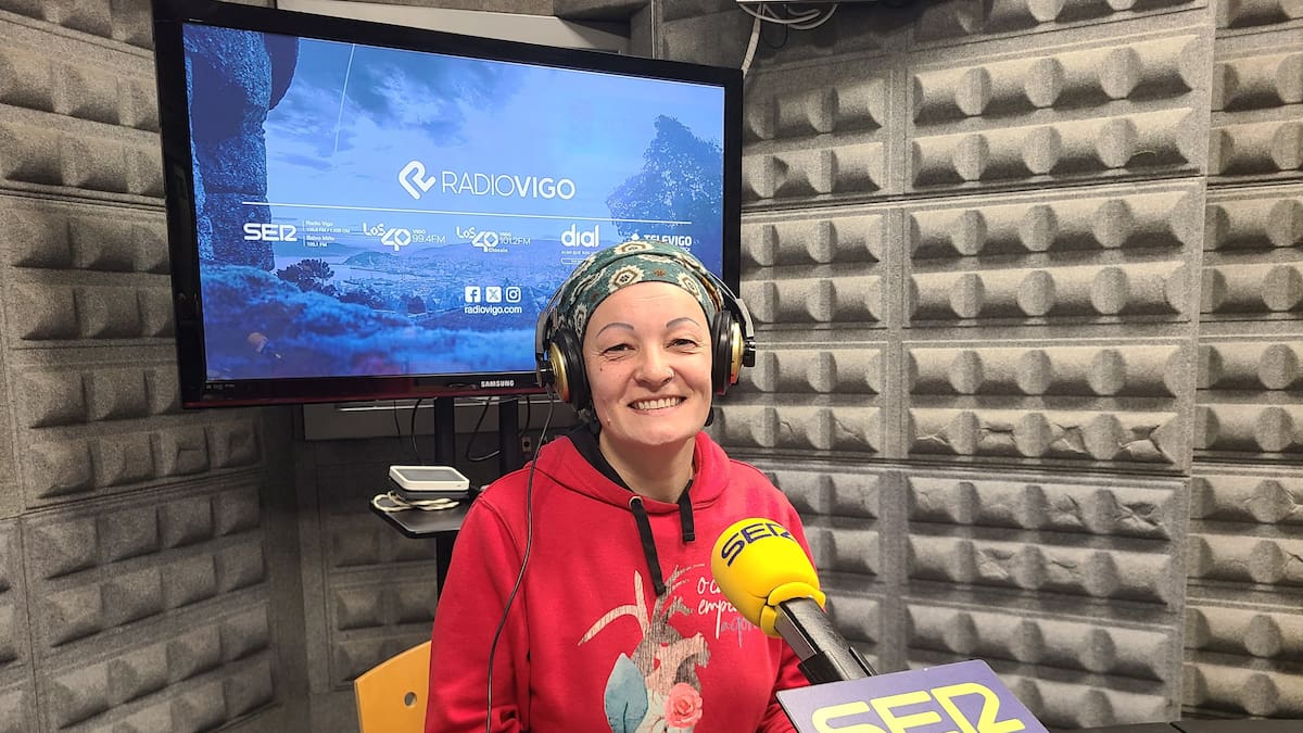 Entrevista a Sandra Alonso y Sandra Román por el documental "Mujeres calvas"