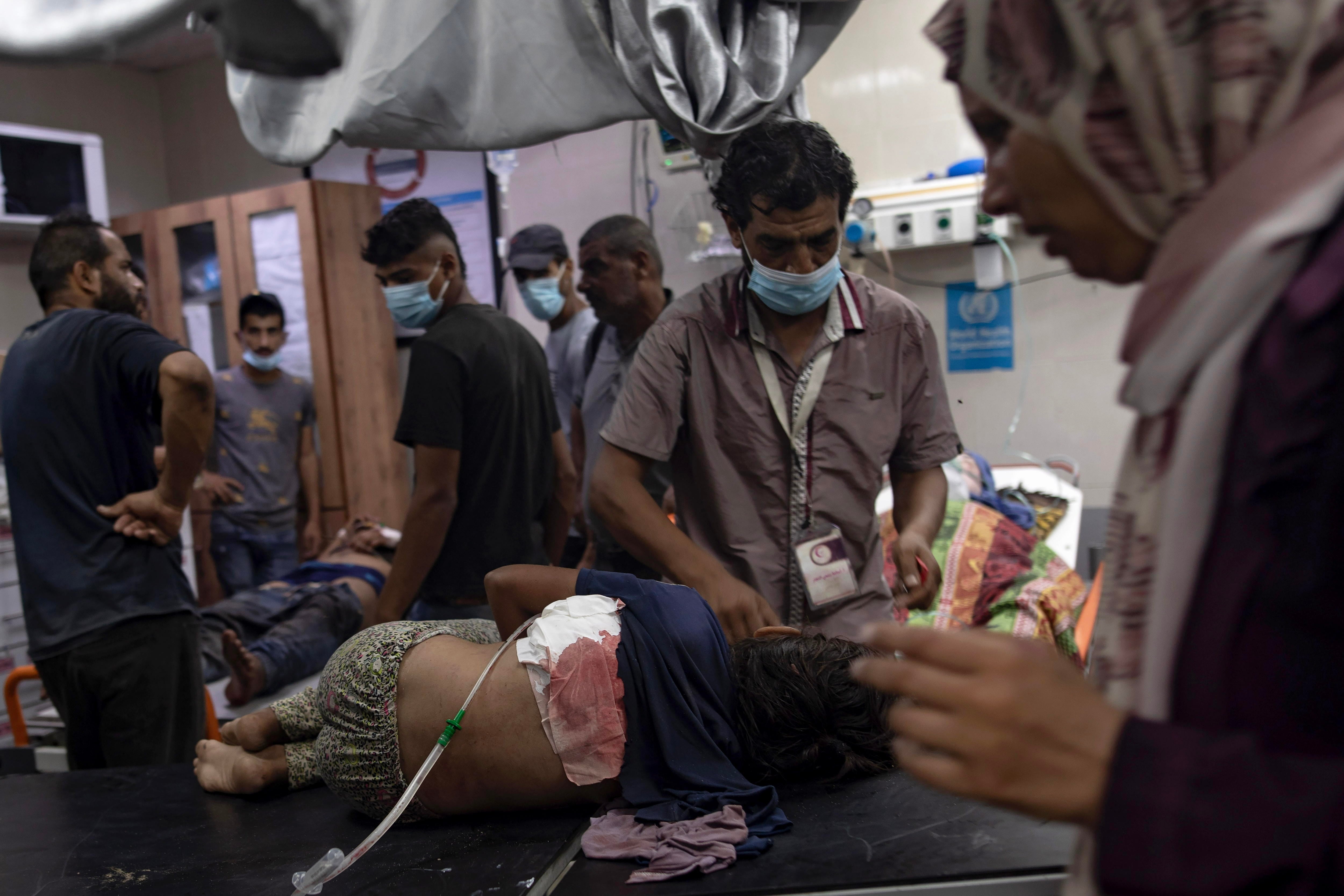 Heridos en el Hospital Nasser de Jan Yunis en Gaza.