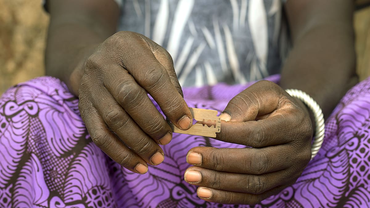 La esperanza de las mujeres mutiladas está en Barcelona y se llama Pere Barri