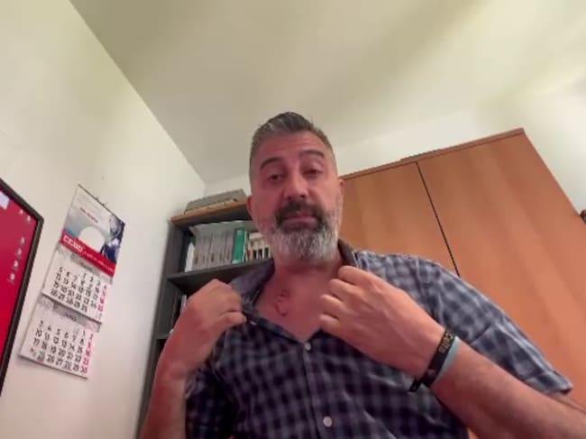 Celso Carnero, de CCOO, mostrando el impacto recibido este jueves 22 durante la manifestación de la huelga del metal