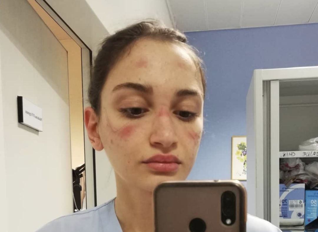 Alessia Bonari, la sanitaria italiana que se hizo viral al denunciar las heridas que sufría 