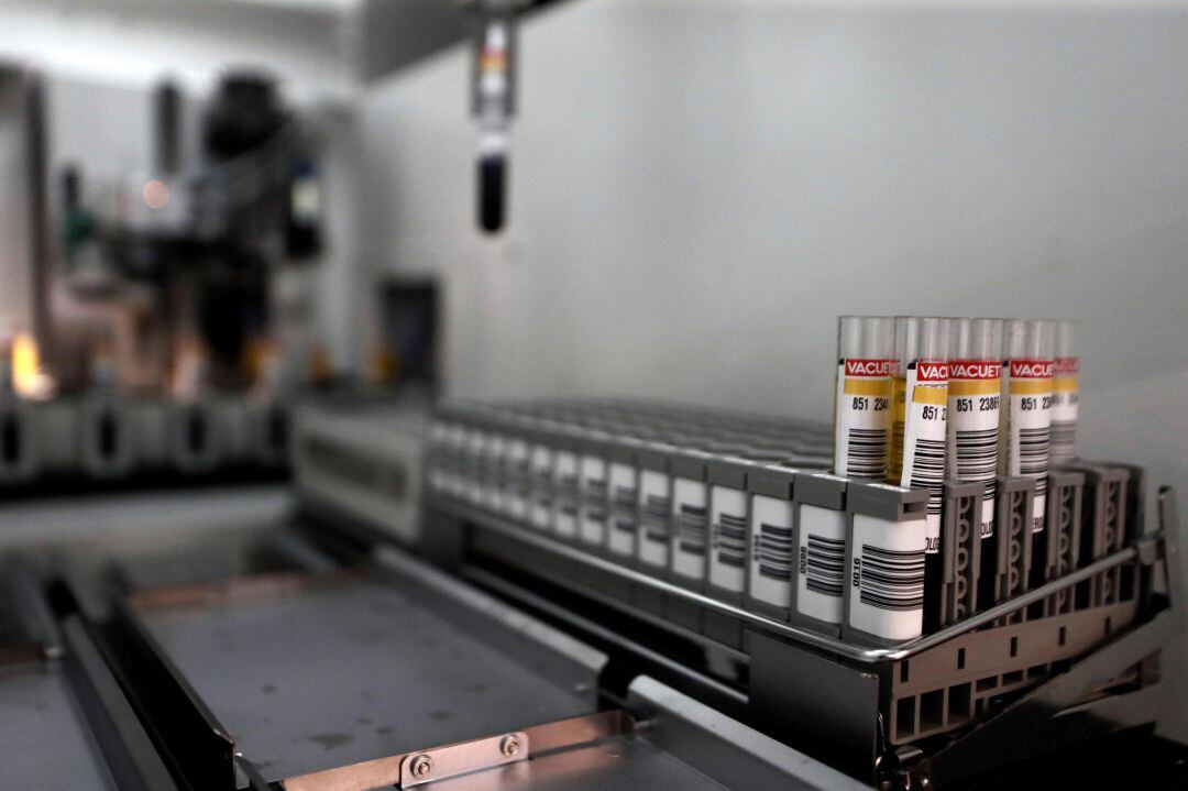 Técnicos de laboratorio del Complejo Hospitalario de Navarra procesan muestras serológicas para su posterior análisis