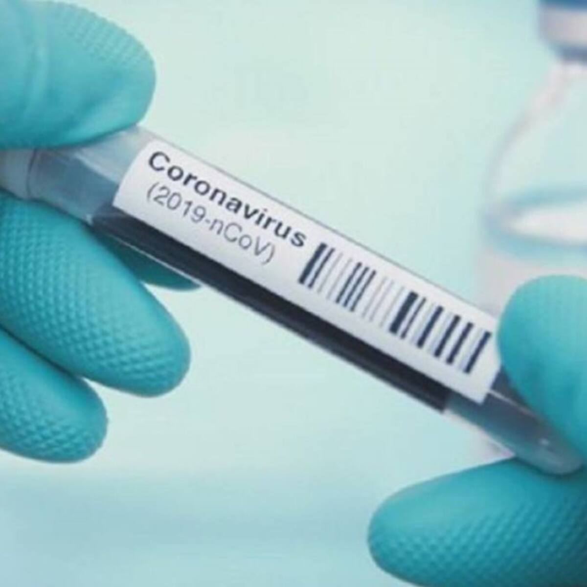 Tres positivos de coronavirus en un campamento de Riópar