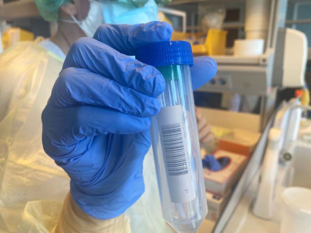 Una muestra de virus.