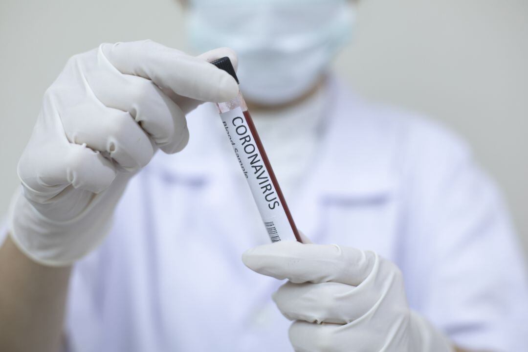 Análisis de sangre para detectar coronavirus