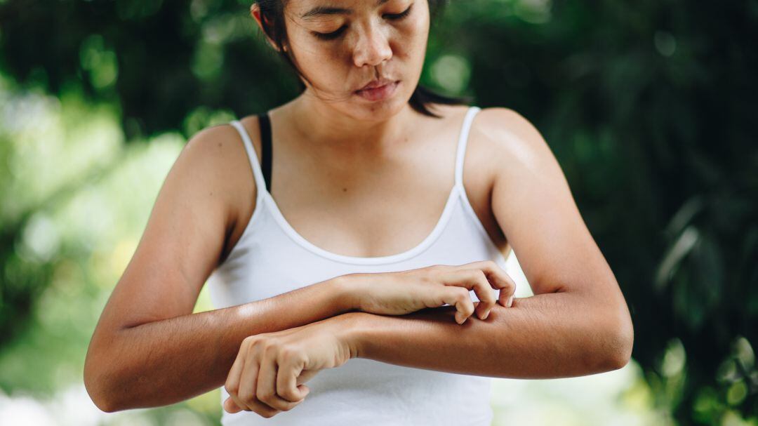 El frío empeora los síntomas de las enfermedades dermatológicas