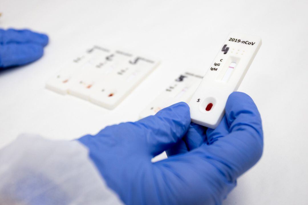 Realización de pruebas PCR