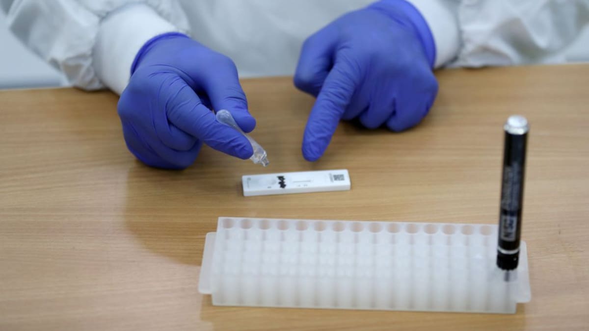 Baja la incidencia acumulada a 14 días por debajo de los 2.000 casos en Baleares