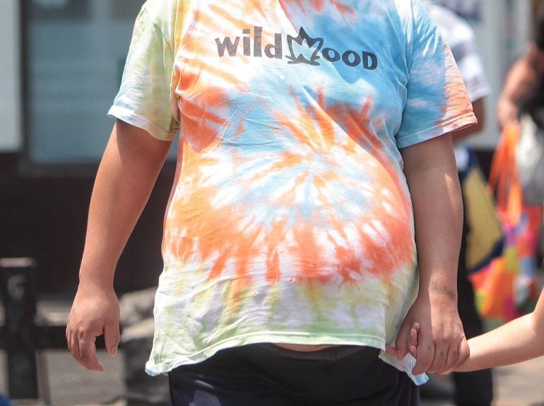 1 de cada 2.000 nadons pateixen hèrnia diafragmàtica congènita