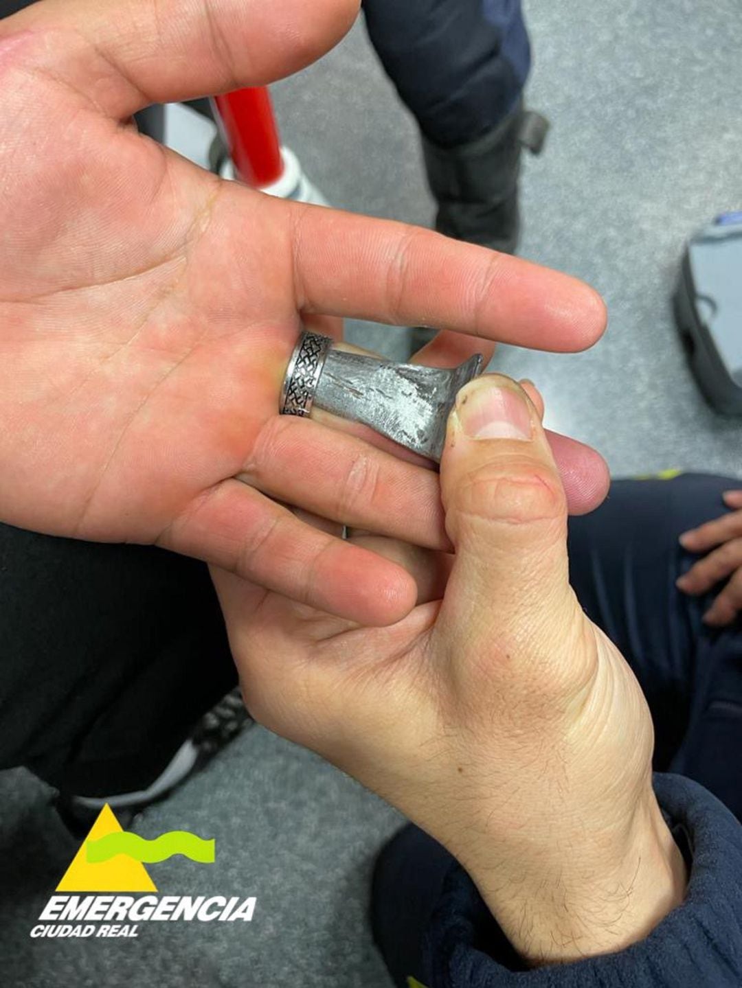 Imagen del anillo atascado en el dedo del adolescente