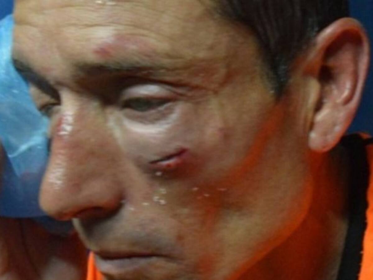 Una brutal agresión a un árbitro provoca la huelga de colegiados en Argentina