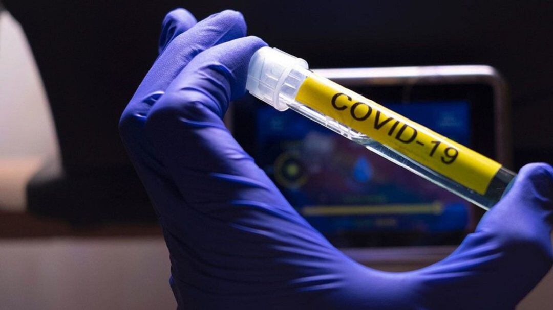 Suben los contagios en Aragón