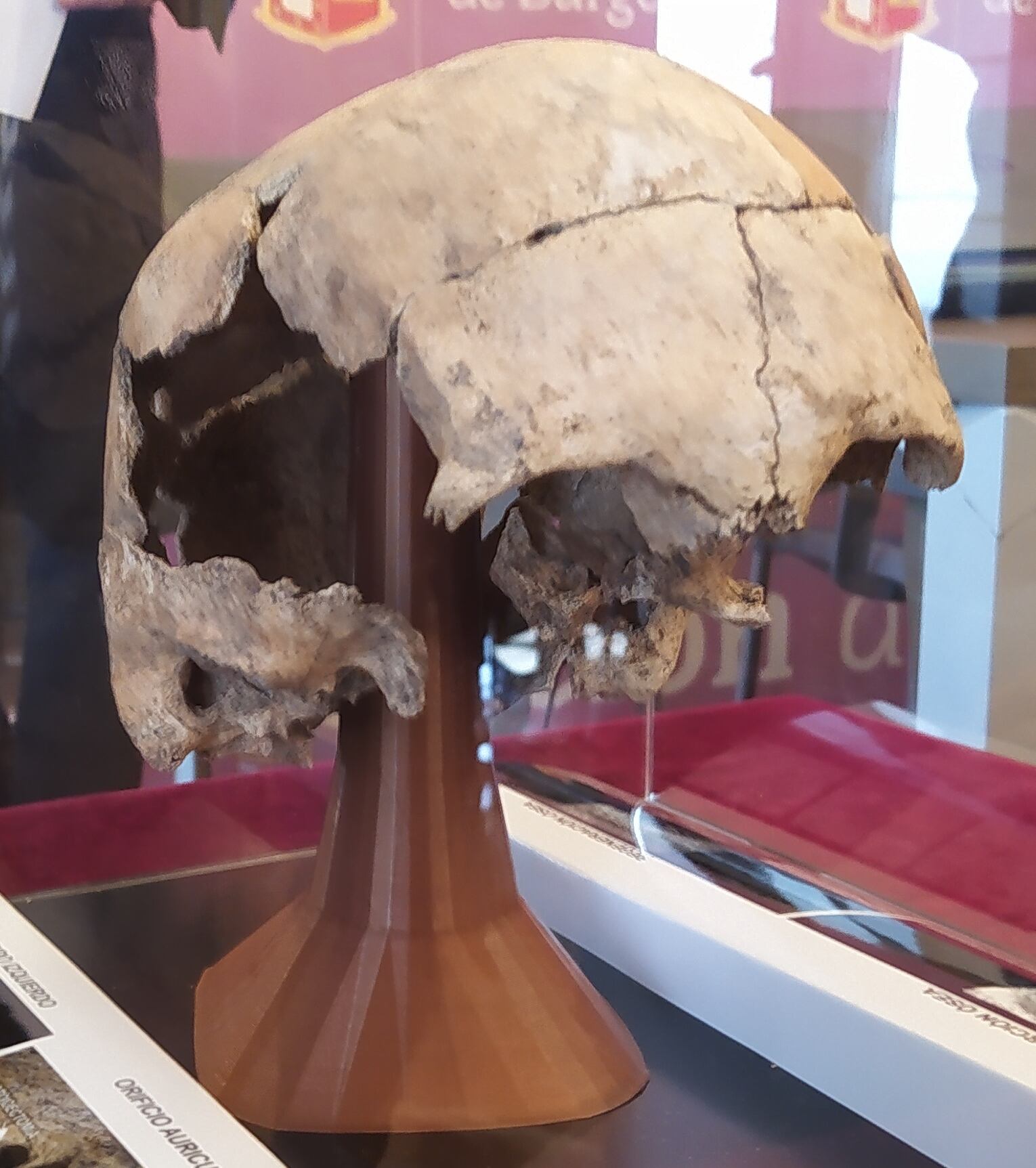 Cráneo de El Pendón donde se ha documentado la primera operación de oído hace 5.000 años