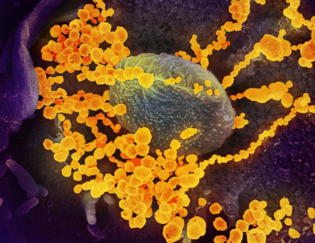 Imagen microscópica del virus SARS-CoV-2, que provoca COVID-19.