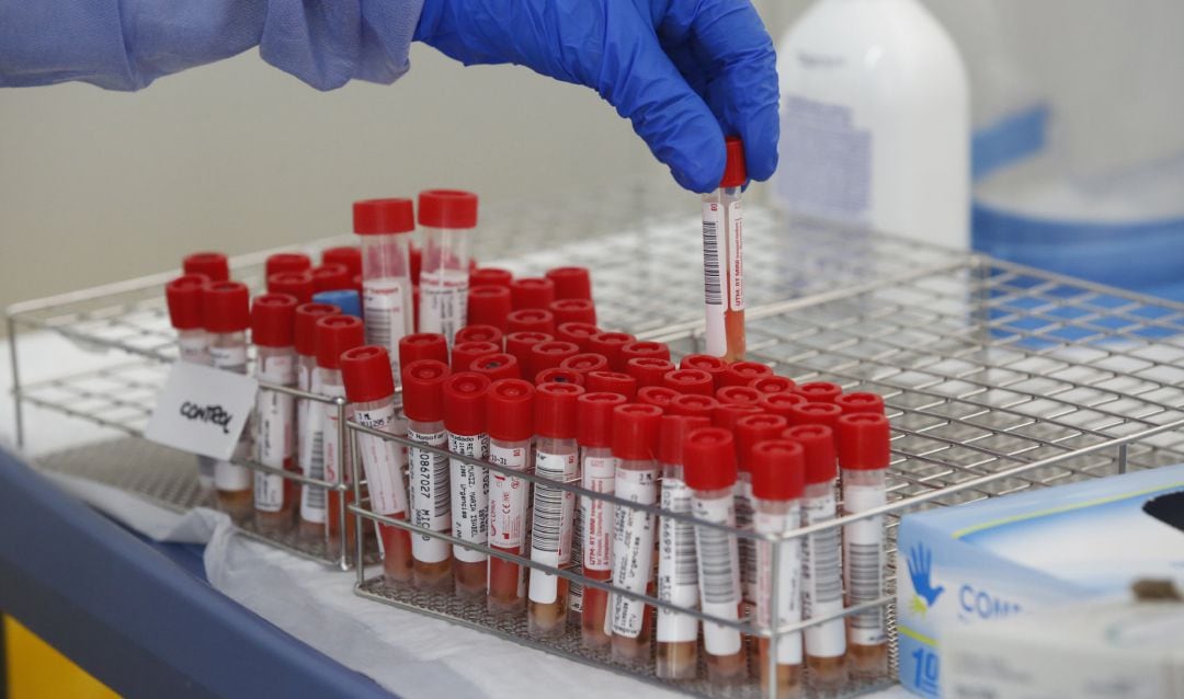 Tubos de pruebas PCR para la detección del COVID-19.