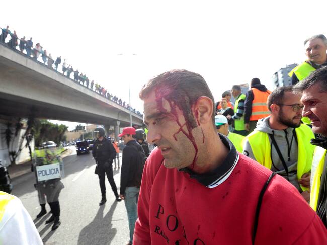 Uno de los manifestantes en la marcha de los agricultores muestra la sangre en la cabeza tras el intento de los agentes de la Policía Nacional para evitar que bloqueen el puerto de Algeciras