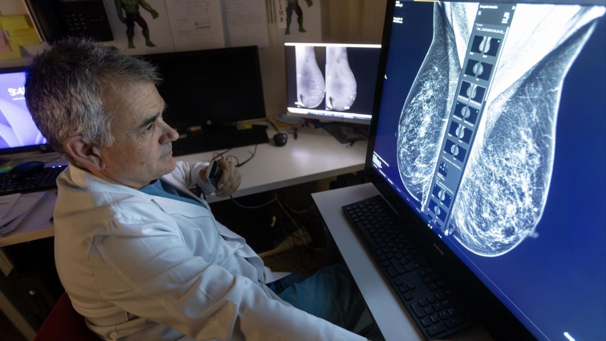 La IA, aliada de los radiólogos para detectar el cáncer de mama