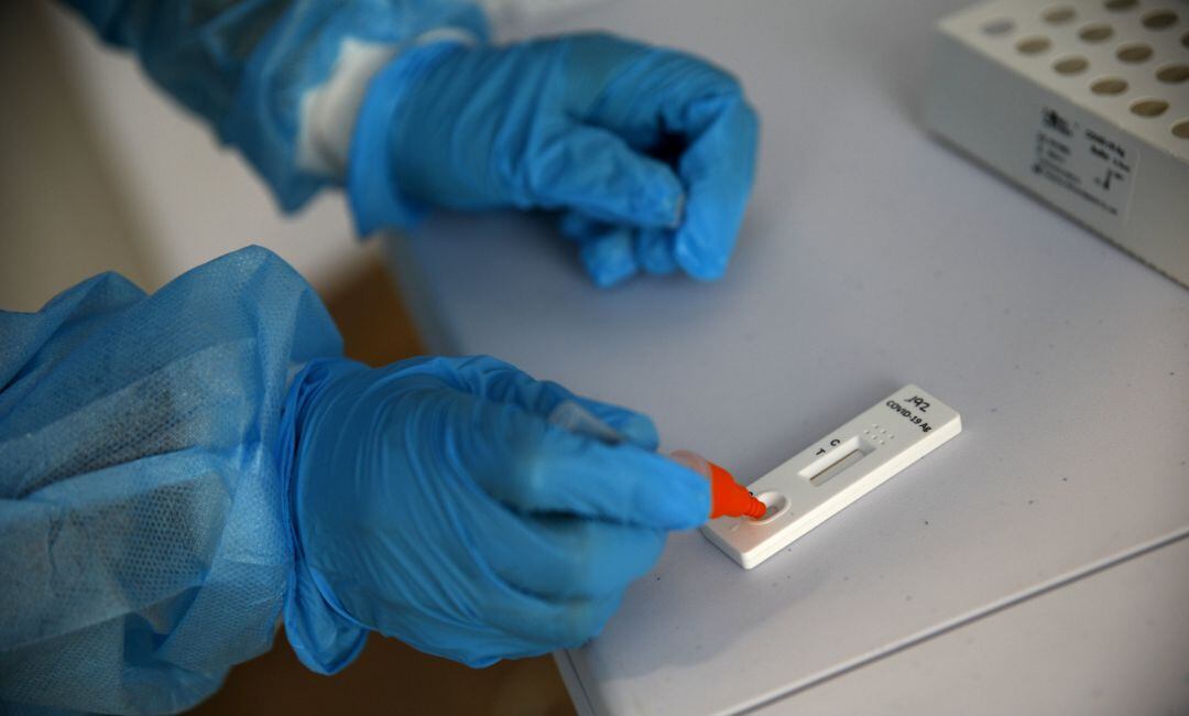 Aragón confirma 232 contagios de COVID-19, de los que 142 son en personas de entre 15 y 24 años.