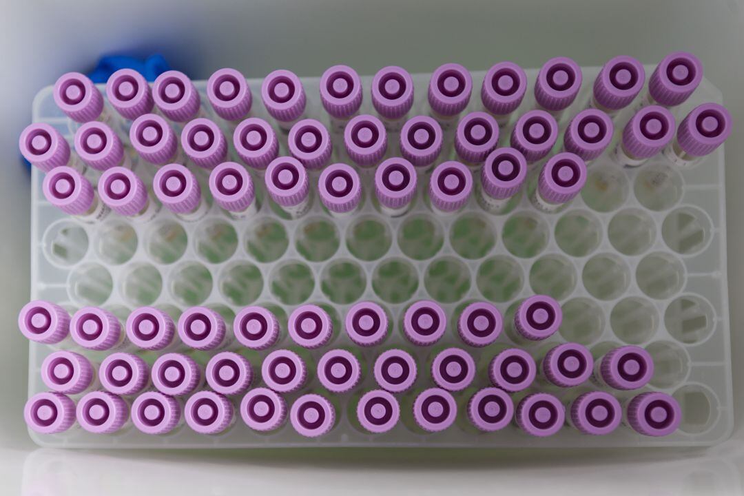 Muestras de PCR en una laboratorio. 