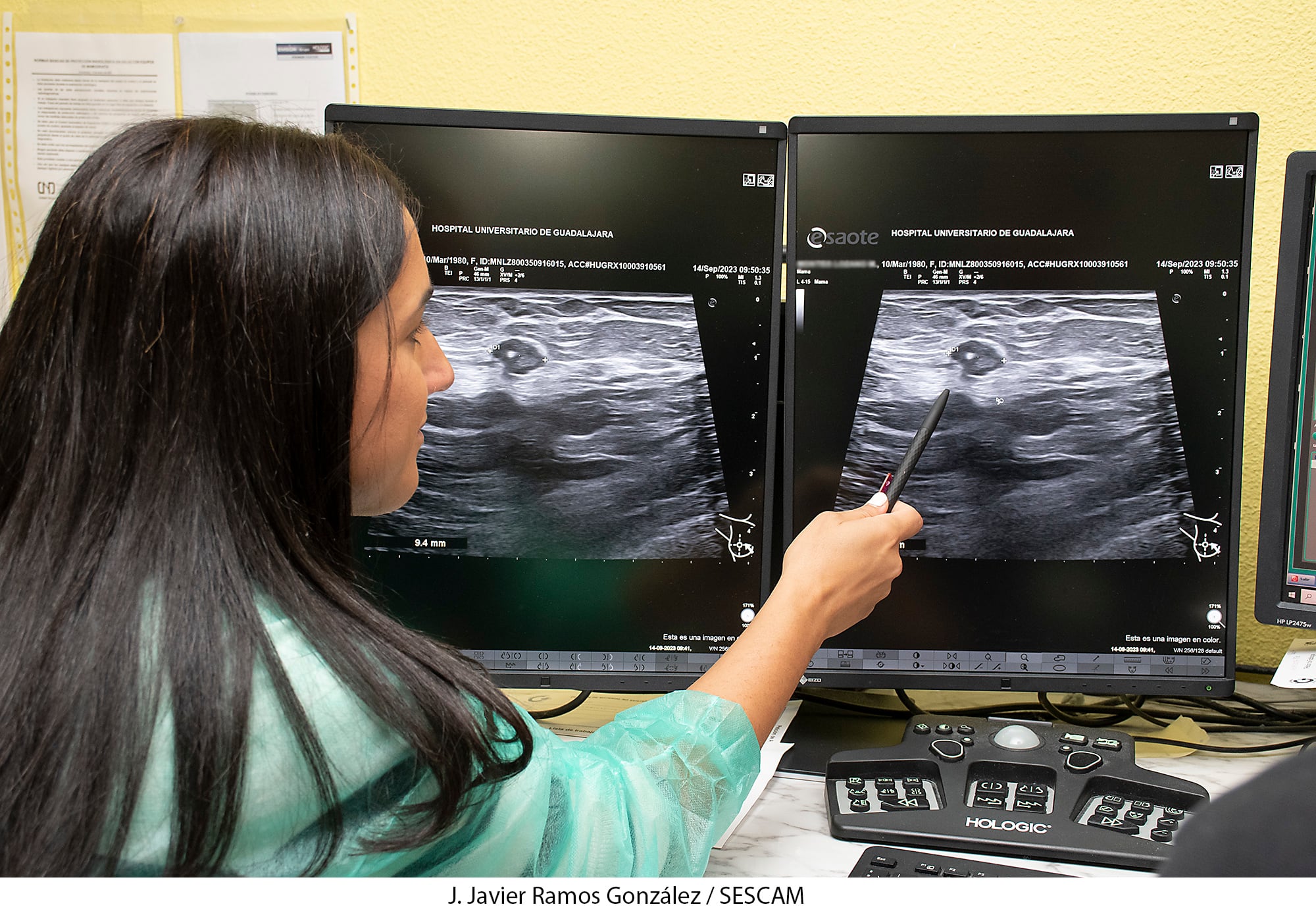 Radióloga observando un cáncer de mama